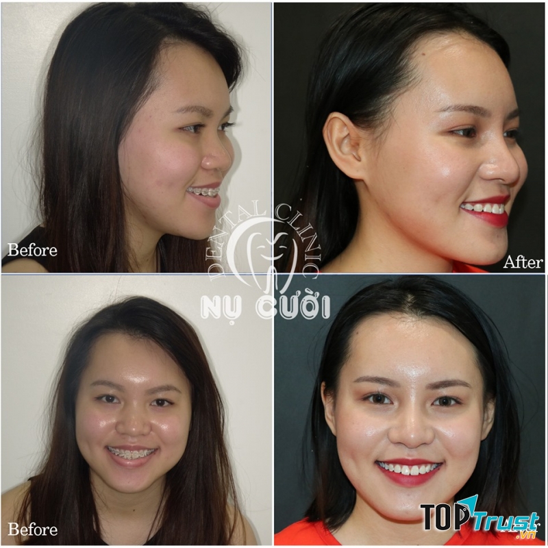 Nha Khoa Nụ Cười