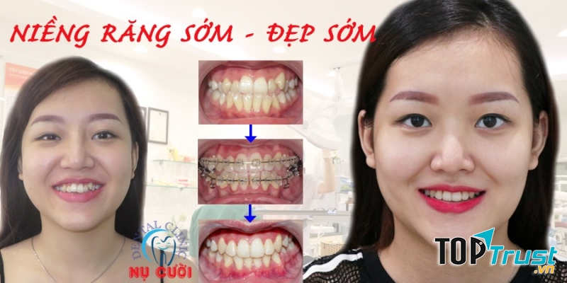 Nha Khoa Nụ Cười