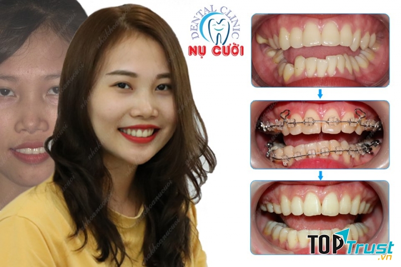 Nha khoa Nụ Cười