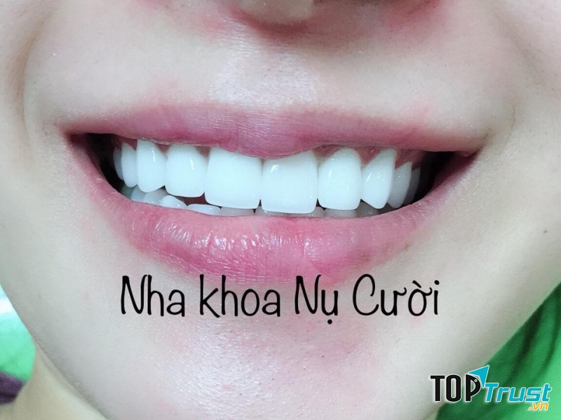 Nha Khoa Nụ Cười