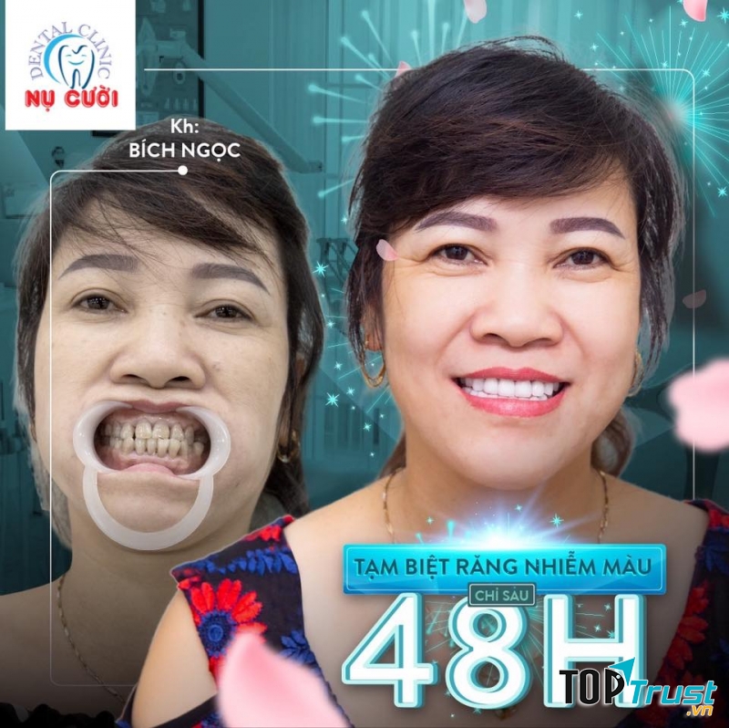 Nha khoa Nụ Cười Cà Mau