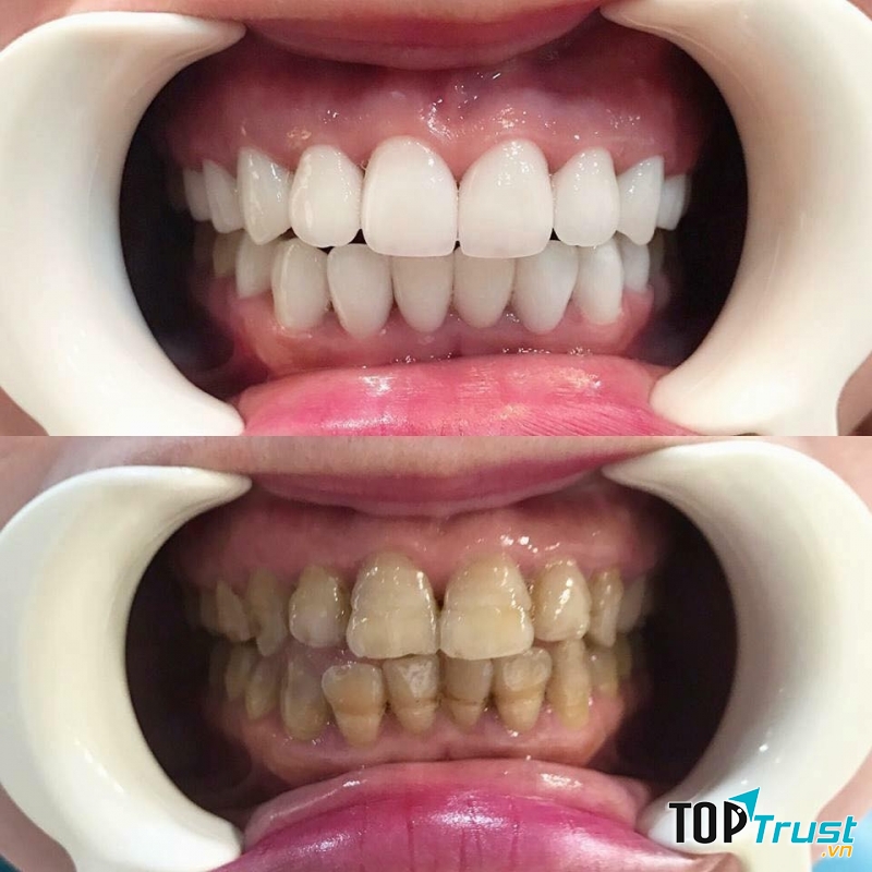 Nha Khoa Nụ Cười Đà Lạt