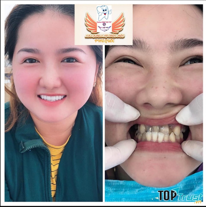 Nha Khoa Nụ Cười Mới