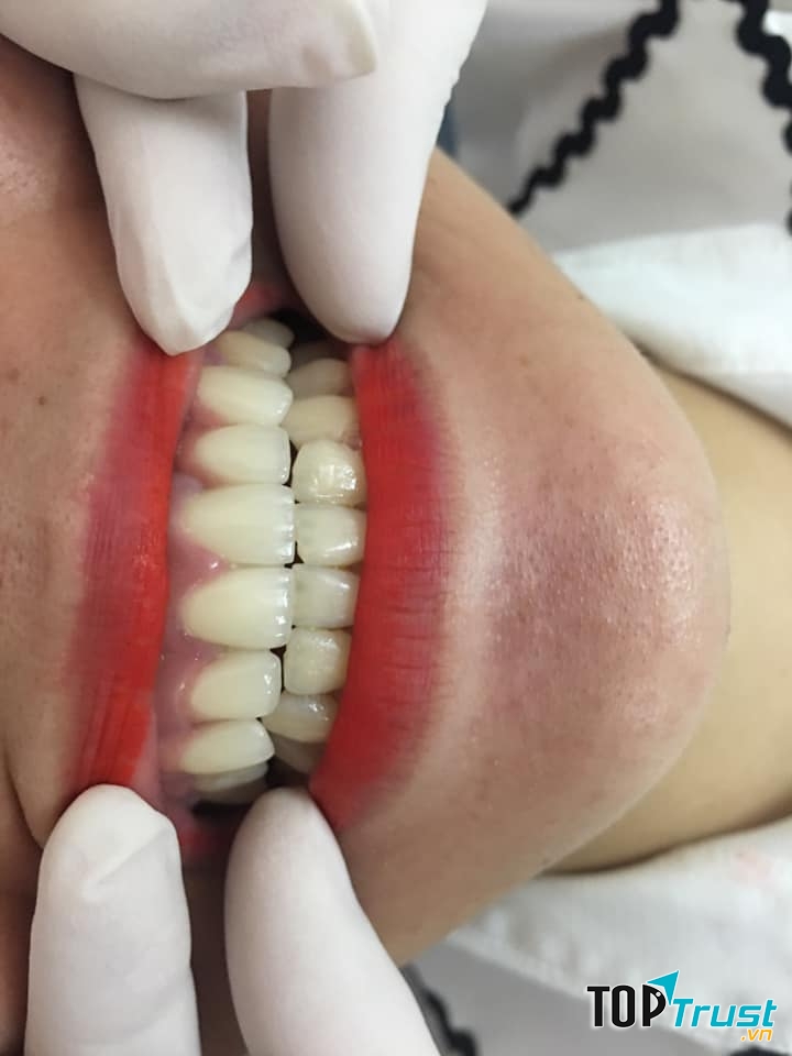 Nha Khoa Nụ Cười Việt