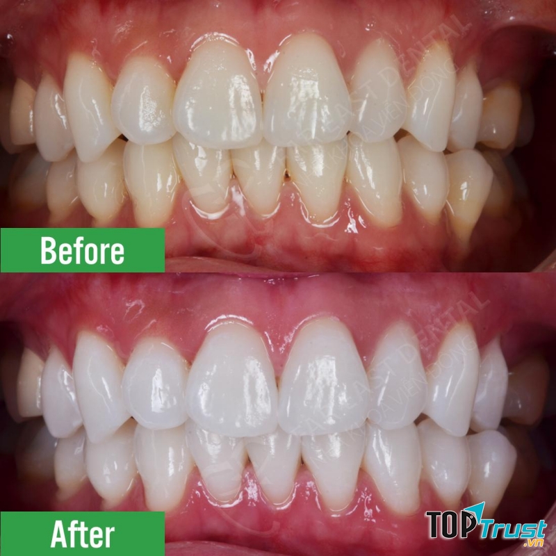 Nha khoa Nụ Cười Việt - Hà Tĩnh