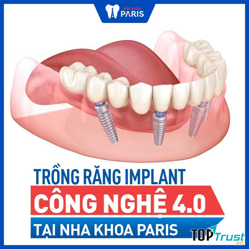 Nha khoa Paris Đà Nẵng