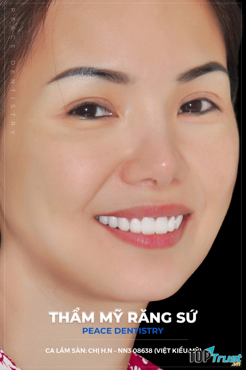 Nha Khoa Peace