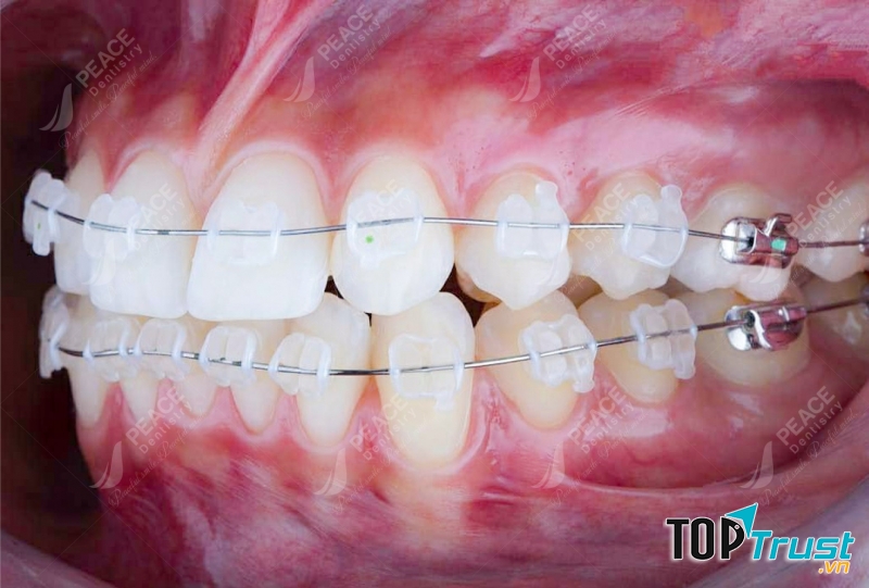 Nha Khoa Peace Dentistry