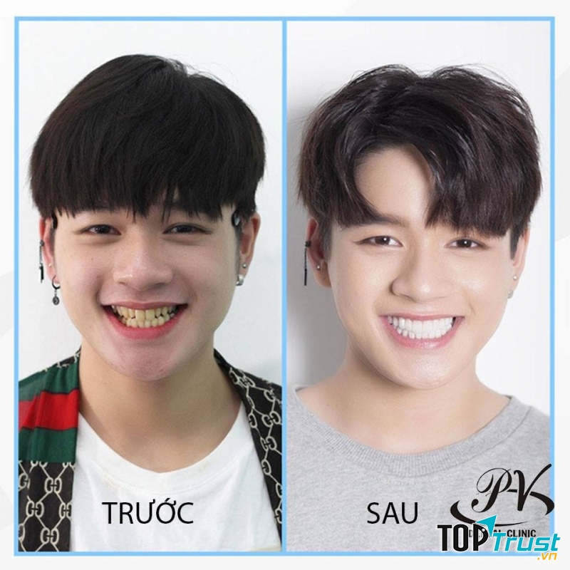 Nha khoa Quốc tế Pháp Việt