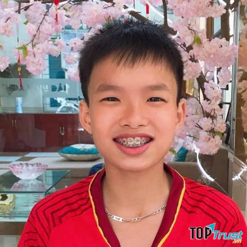 Nha Khoa Pháp Việt Tô Ký