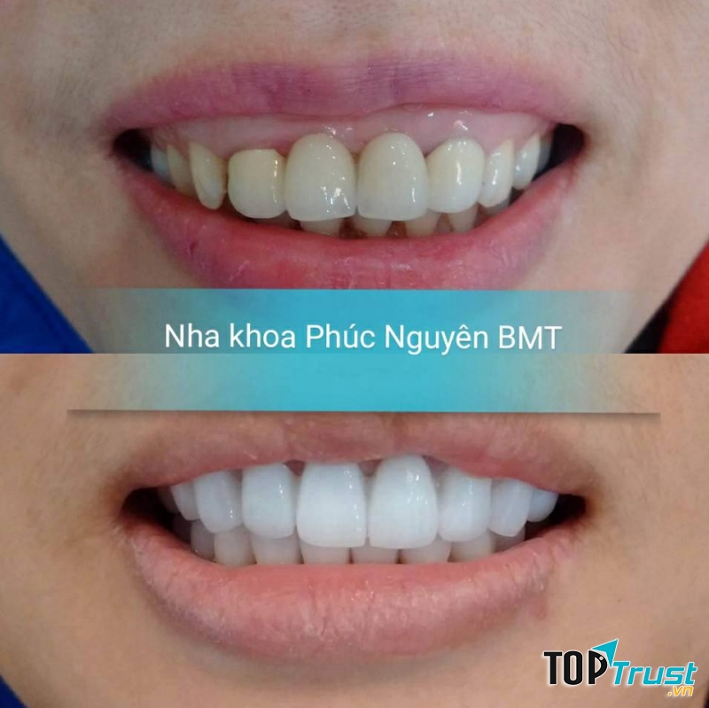 Nha khoa Phúc Nguyên