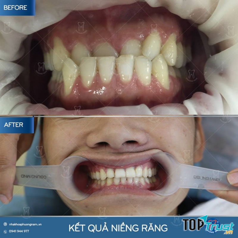 Nha khoa Phương Nam