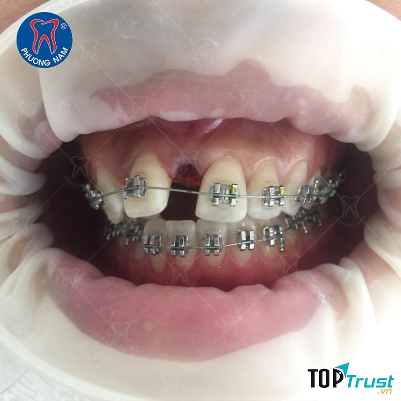 Nha khoa Phương Nam