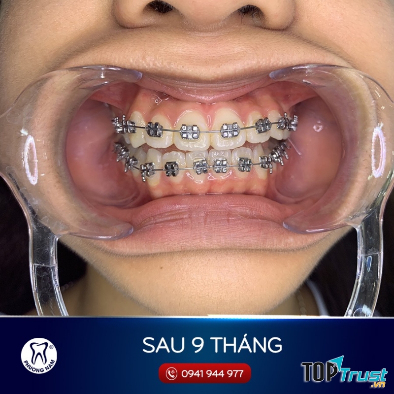 Nha khoa Phương Nam