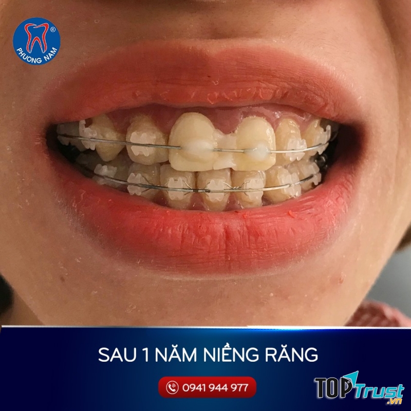 Nha khoa Phương Nam