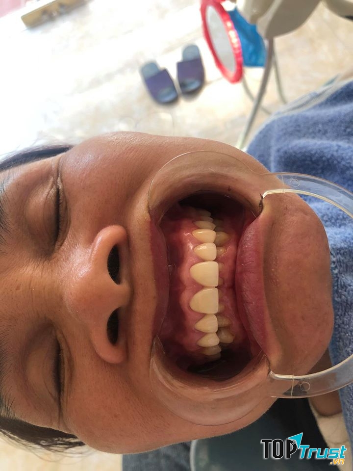 NHA KHOA QUỐC TẾ