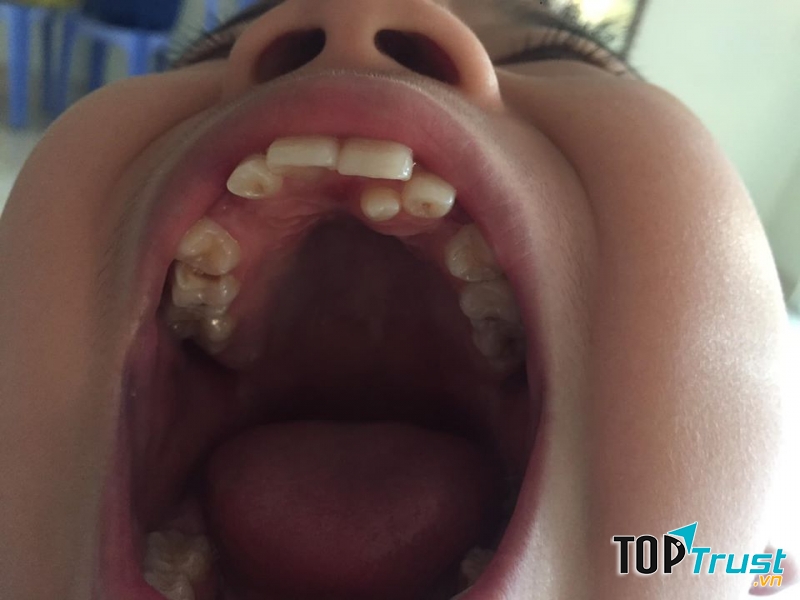 NHA KHOA QUỐC TẾ