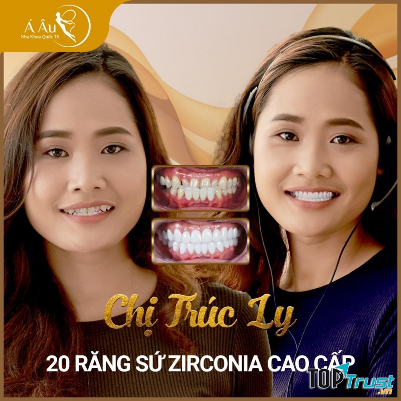 Nha Khoa Quốc Tế Á Âu