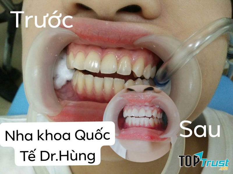 Nha khoa Quốc tế Cà Mau