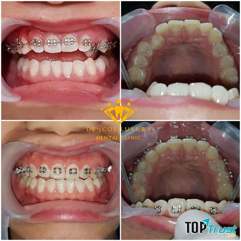 Nha Khoa Quốc Tế Dencos Luxury