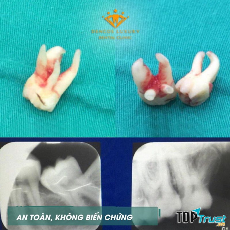 Nha Khoa Quốc Tế Dencos Luxury