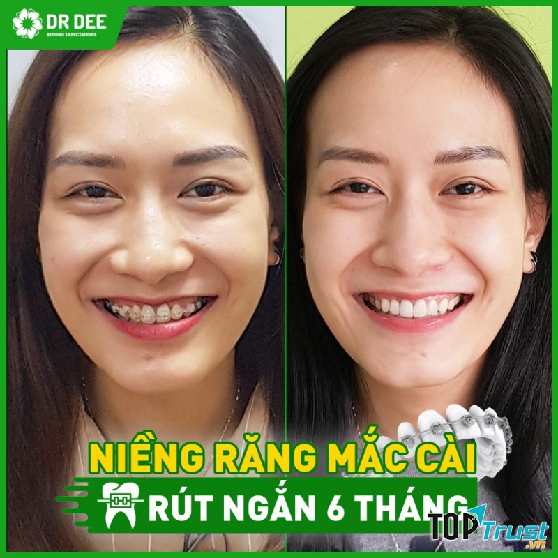 Nha Khoa Quốc Tế DR DEE