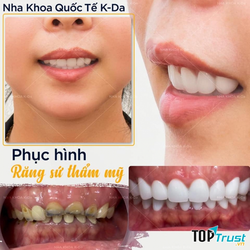 Nha Khoa Quốc Tế K-Da