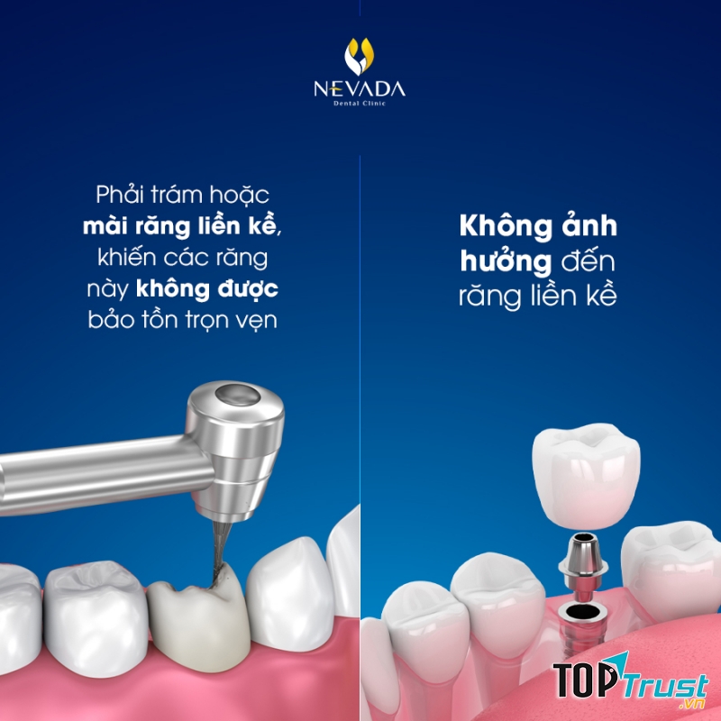 Nha Khoa Quốc Tế Nevada