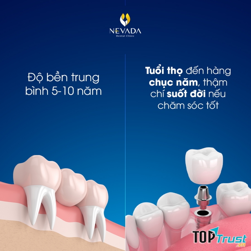 Nha Khoa Quốc Tế Nevada