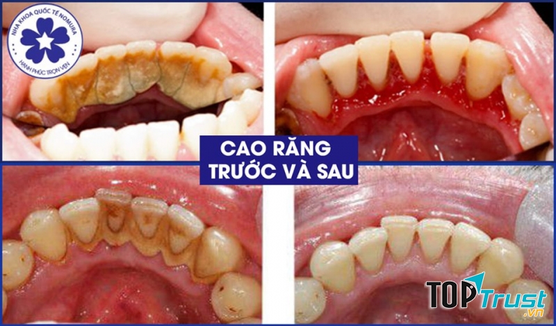 Nha khoa quốc tế Nomura