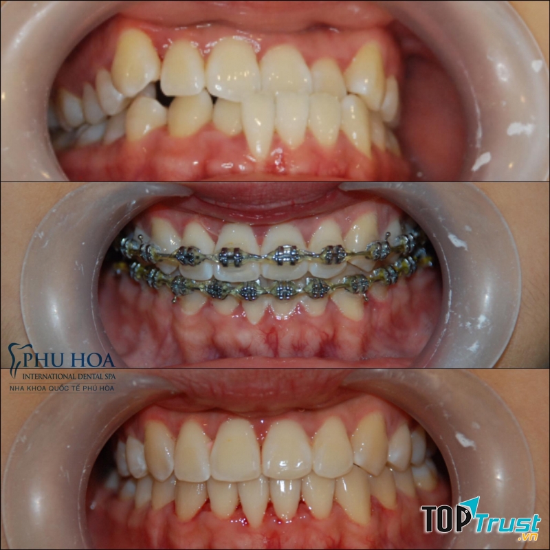 Nha khoa quốc tế Phú Hòa