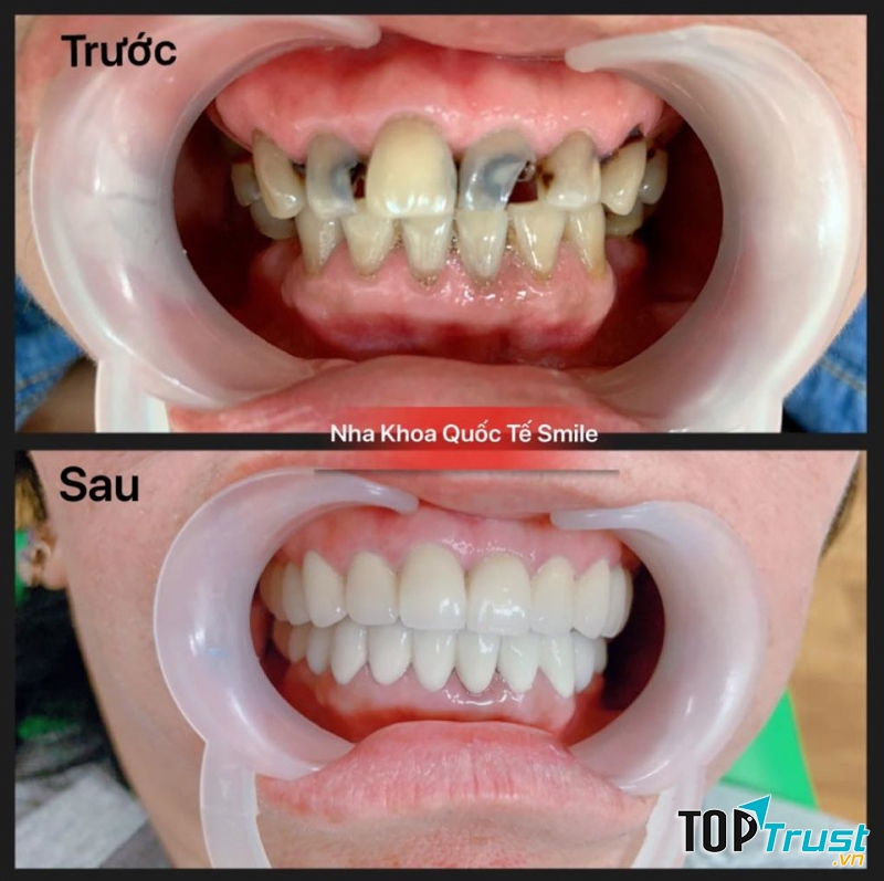 Nha khoa Quốc tế Smile