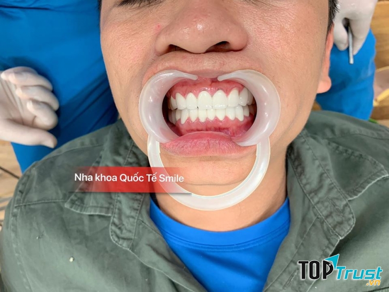 Nha khoa Quốc tế Smile