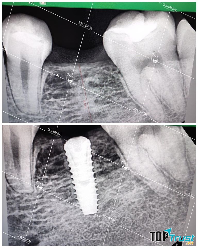 Nha Khoa Quốc Tế SOS Dental