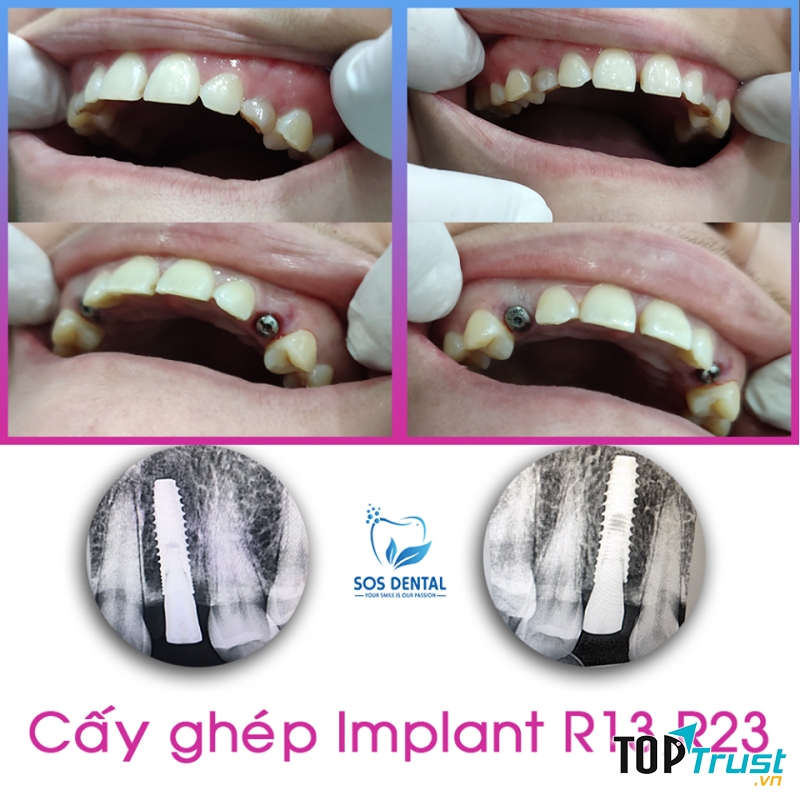 Nha Khoa Quốc Tế SOS Dental