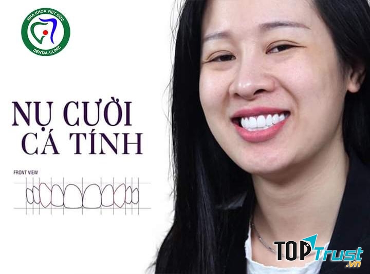NHA KHOA QUỐC TẾ VIỆT ĐỨC