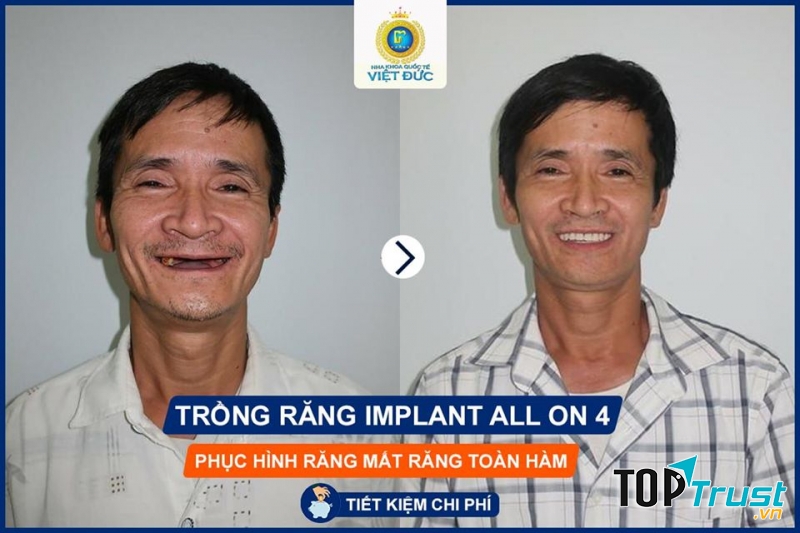 Nha Khoa quốc tế Việt Đức