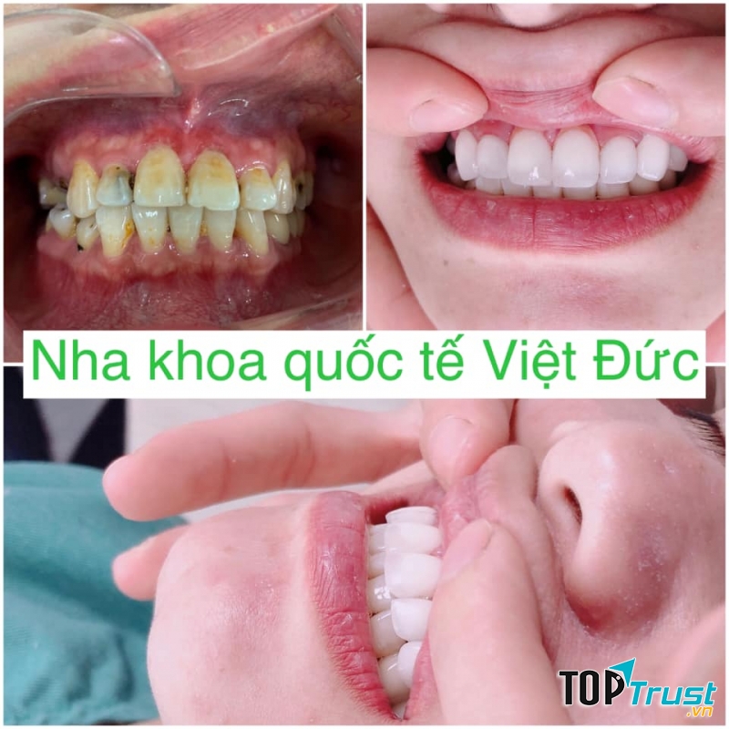 Nha khoa Quốc tế Việt Đức