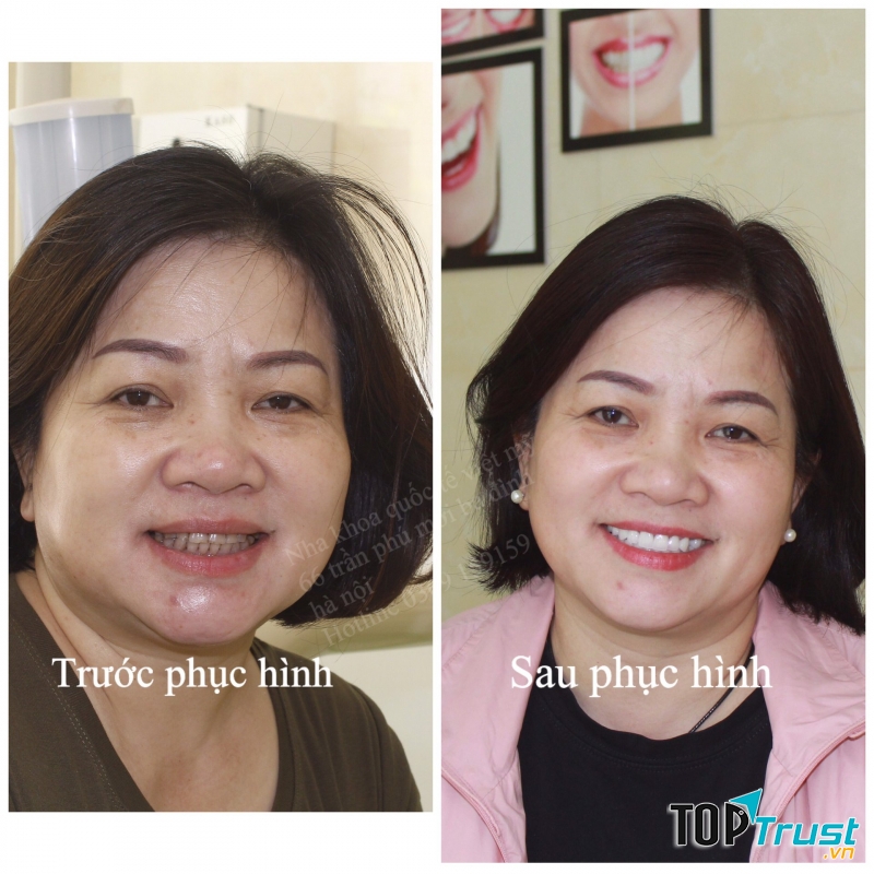 Nha Khoa Quốc Tế Việt Mỹ