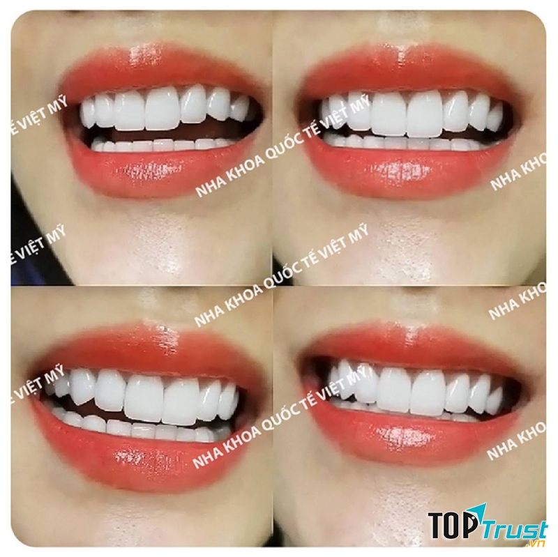 Nha Khoa Quốc Tế Việt Mỹ