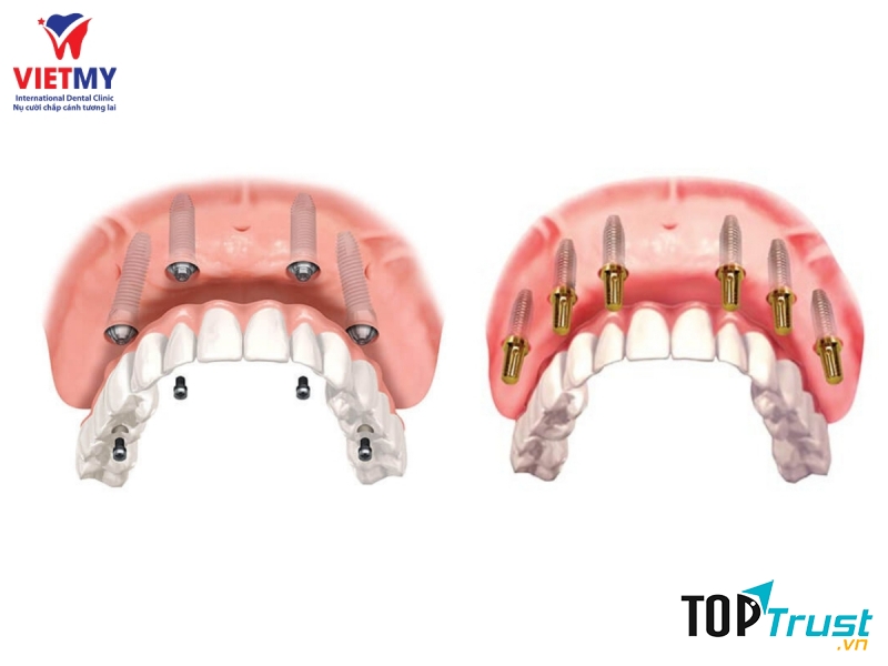 Nha Khoa Quốc Tế Việt Mỹ