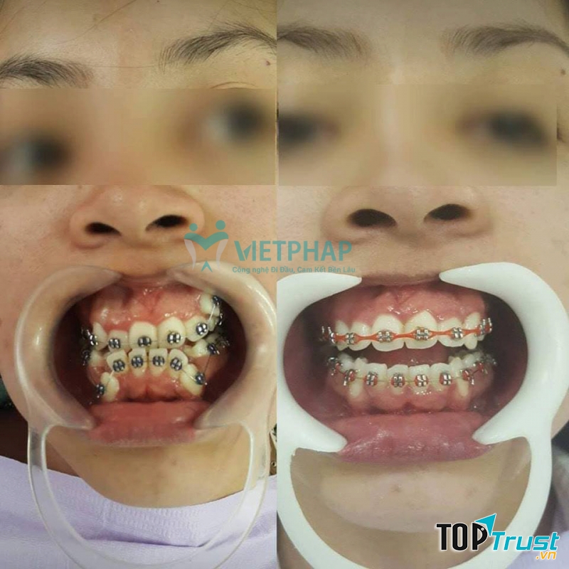 Nha khoa Quốc Tế Việt Pháp