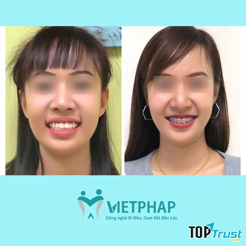Nha khoa Quốc Tế Việt Pháp