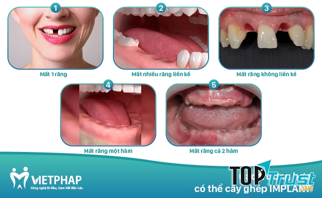 Nha khoa Quốc Tế Việt Pháp