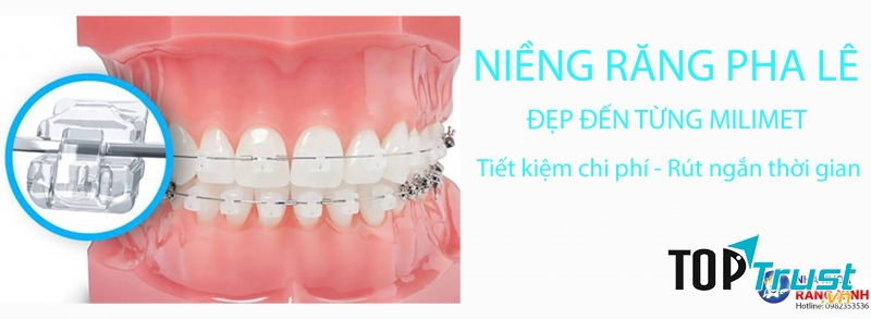 Nha khoa răng xinh, TP Vinh