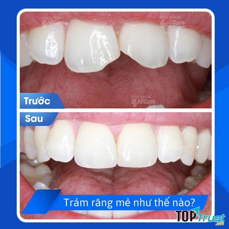 Nha khoa Sài Gòn B.H