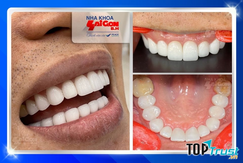 Nha khoa Sài Gòn B.H