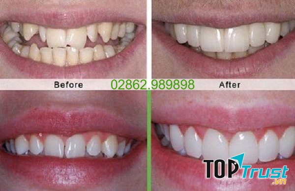 Nha khoa Sài Gòn Dental