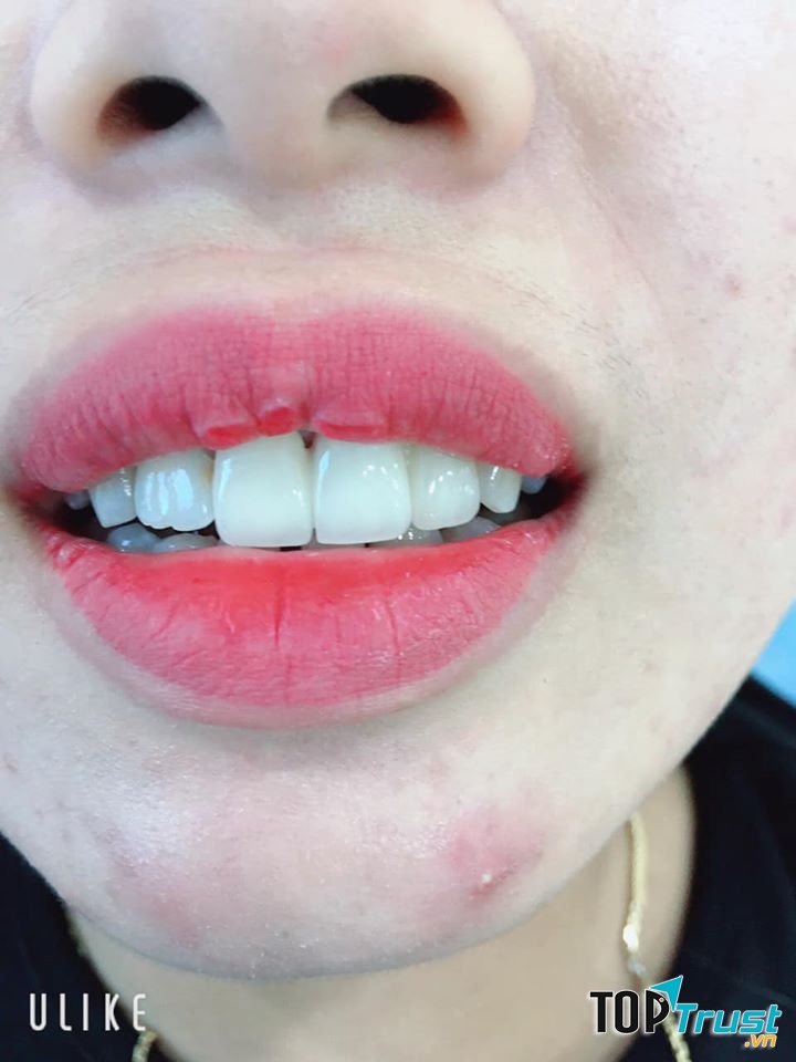 Nha khoa Sài Gòn Duy Xuyên