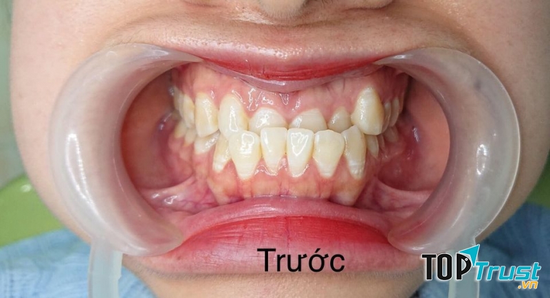 Nha khoa Sài Gòn Hải Phòng